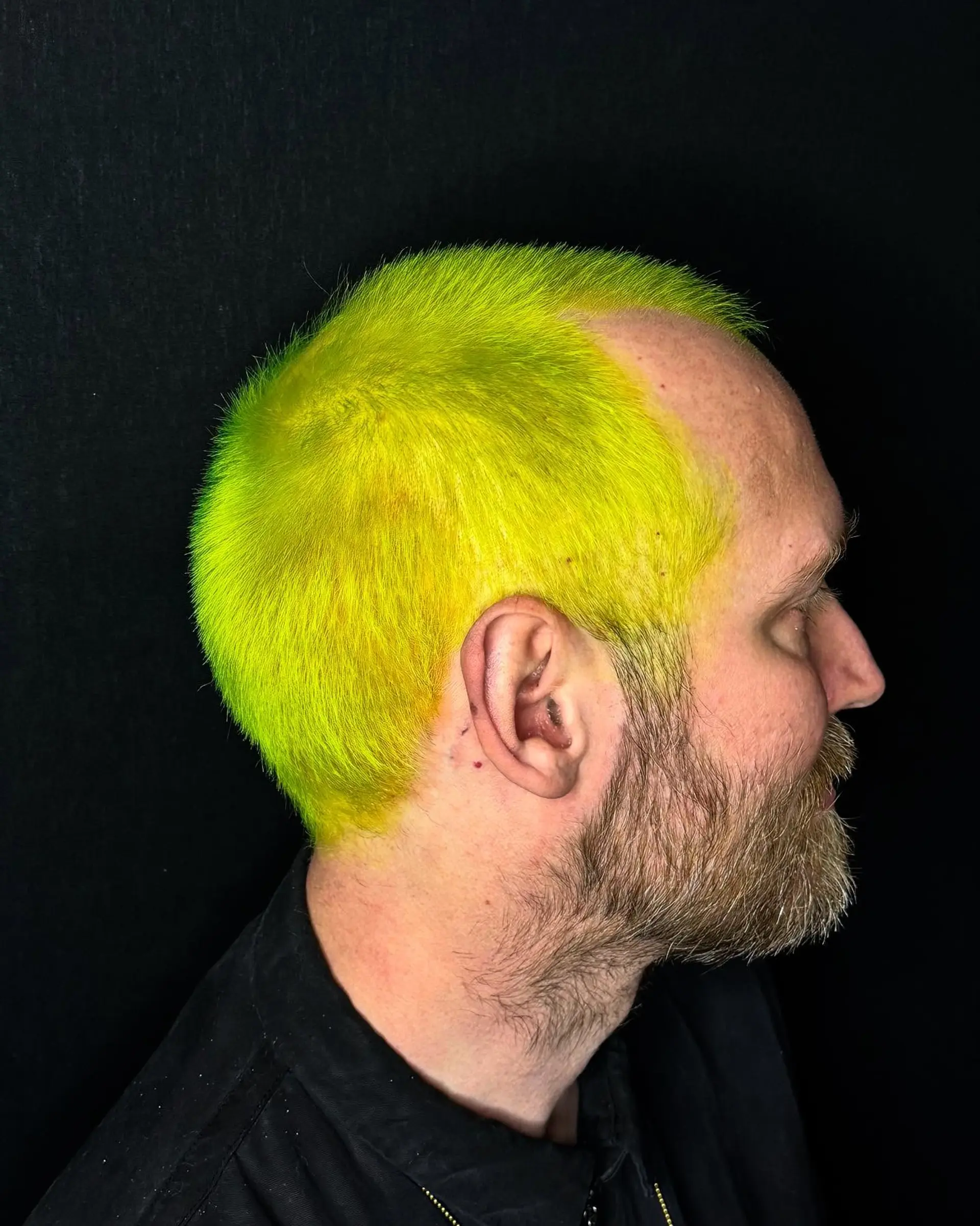 A vibrant neon yellow buzz cut. 1