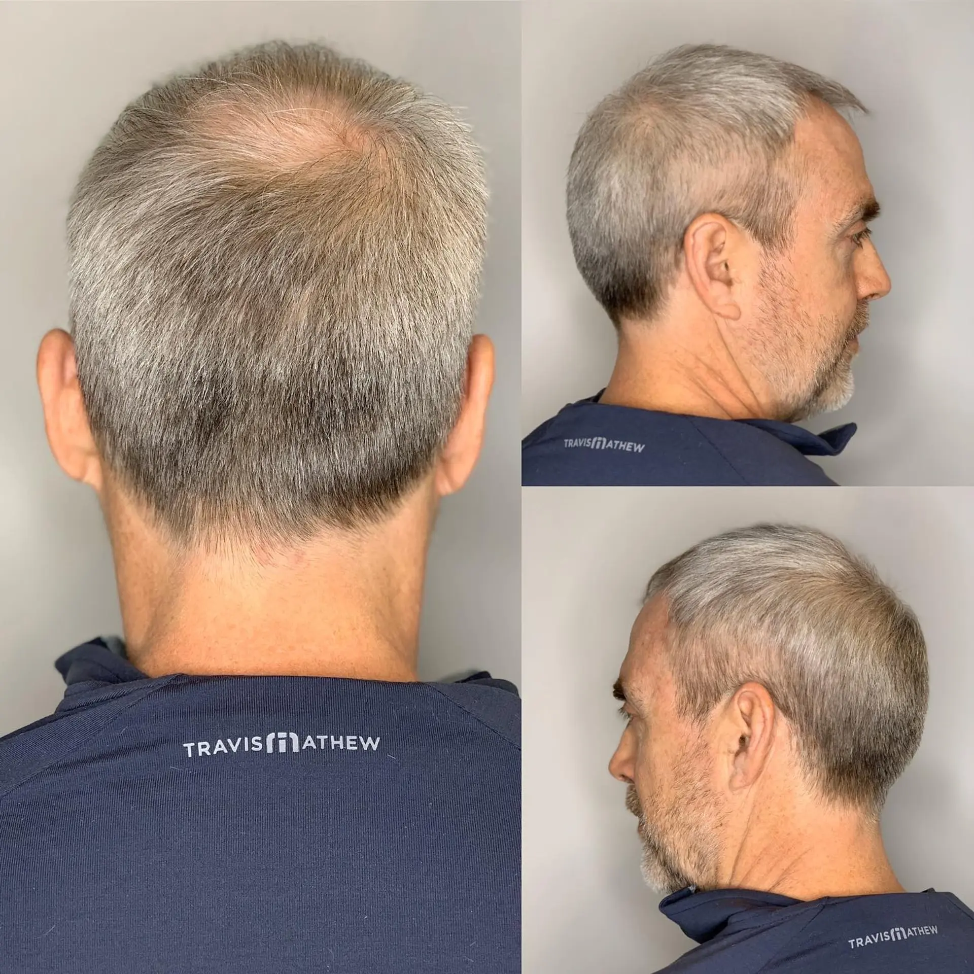 A short, tapered haircut that is easy to maintain and gives a clean, professional appearance. 1