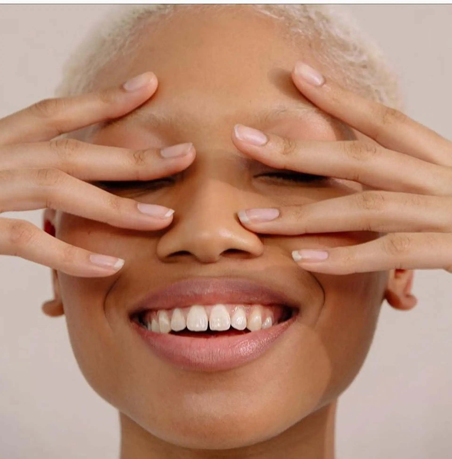 A closely clipped buzz cut in an icy platinum blonde tone. 1